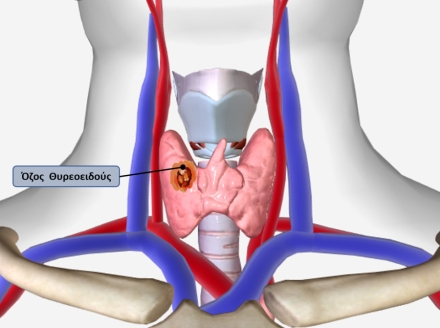 Οζος Θυρεοειδούς