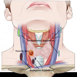 Προεγχειρητική χαρτογράφηση Θυρεοειδούς - Τραχήλου